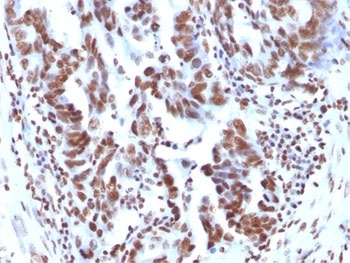 H1F0 Antibody