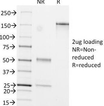 GFAP Antibody