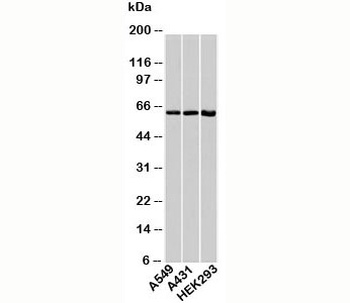 HSPD1 Antibody
