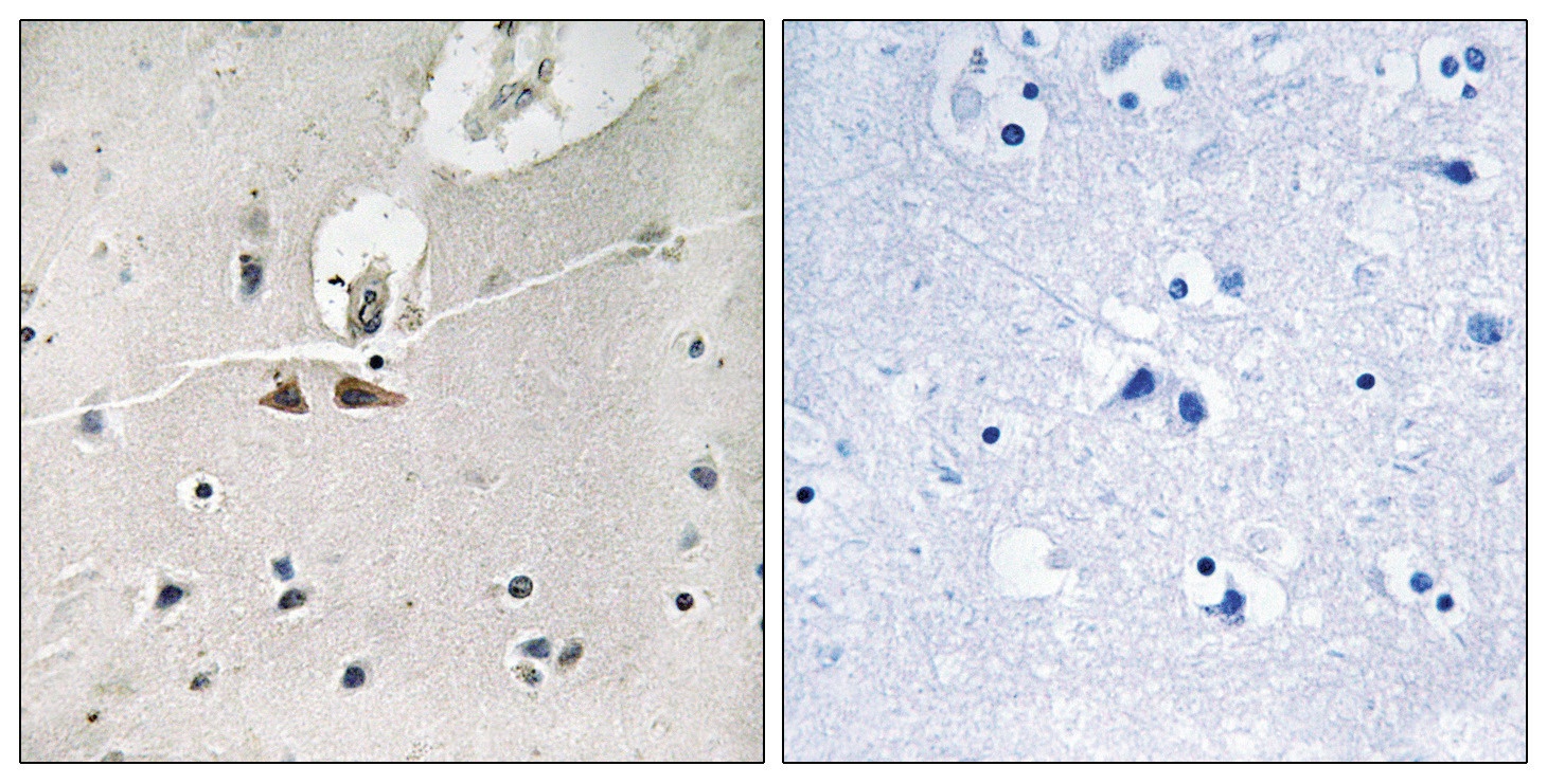 EFNB1, EFNB2, EFNB3 Antibody