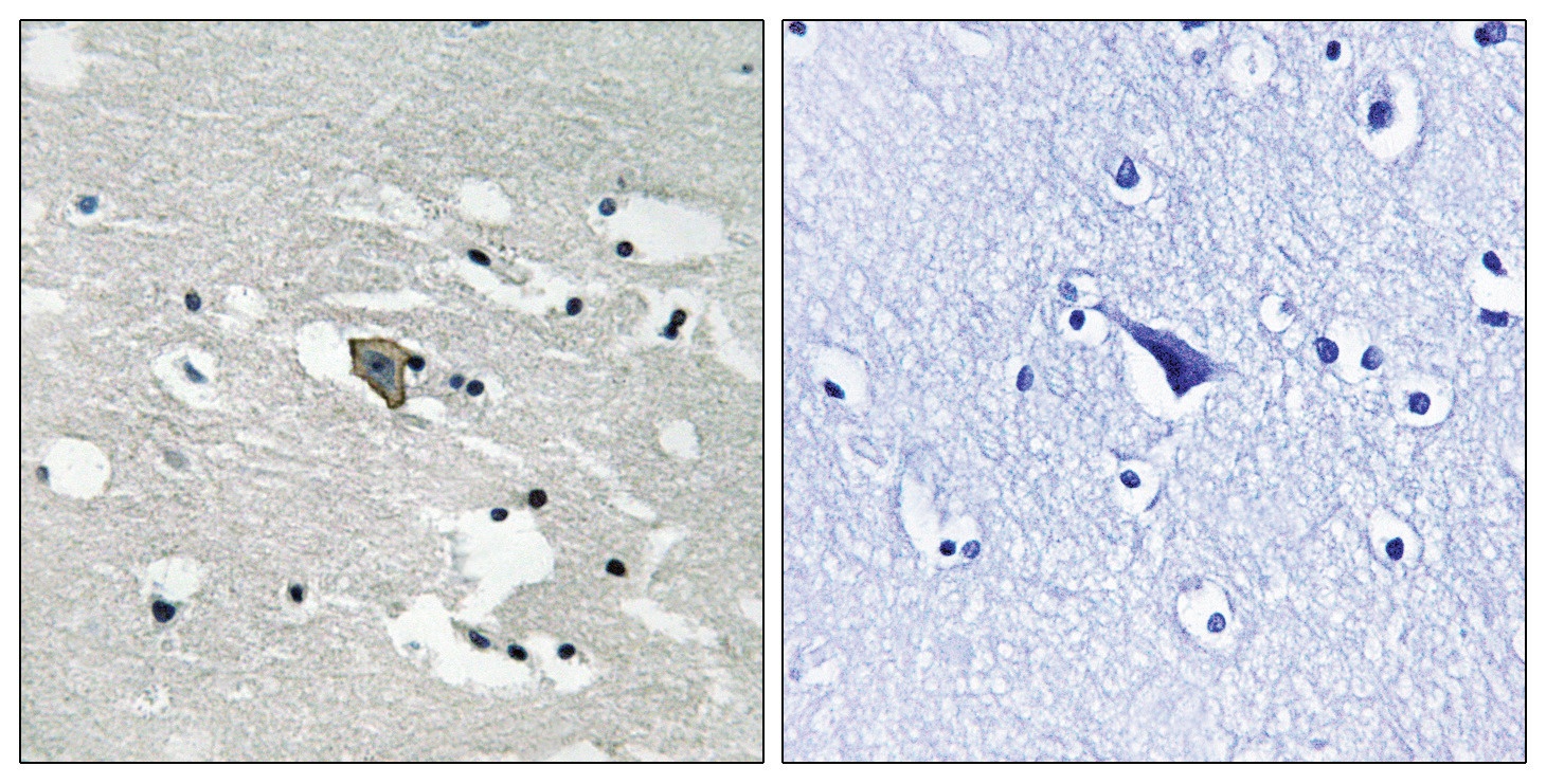 FLT1 Antibody