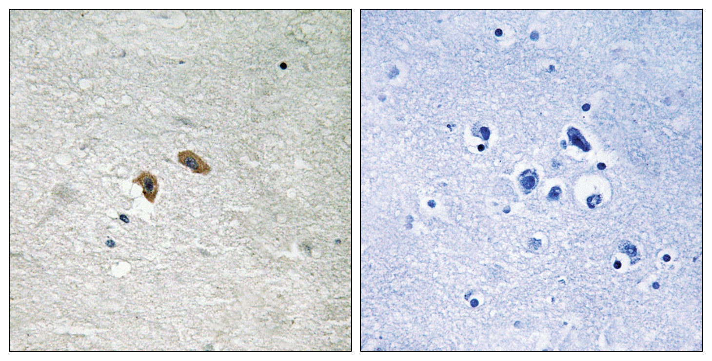 RAF1 Antibody