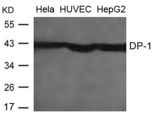 TFDP1 Antibody