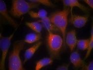 MYL12A Antibody