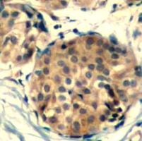 KIT Antibody