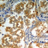 PRKCZ Antibody