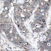 HSPB1 Antibody