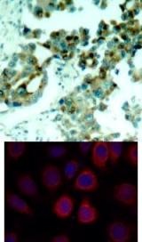 RPS6 Antibody