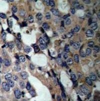 HSPB1 Antibody