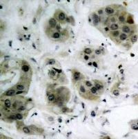 AKT1 Antibody