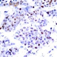 STAT6 Antibody