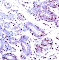 STAT1 Antibody