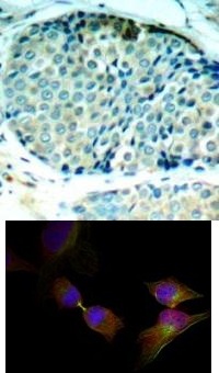 HSPB1 Antibody