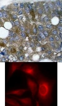 HSPB1 Antibody
