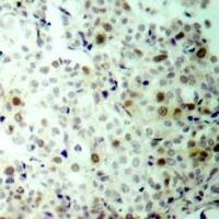 CDK2 Antibody