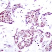 STAT6 Antibody