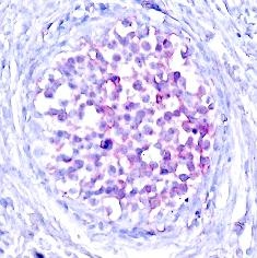 RAF1 Antibody