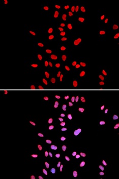 DKC1 Antibody
