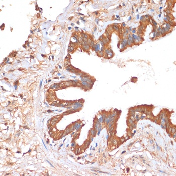 HHLA2 Antibody