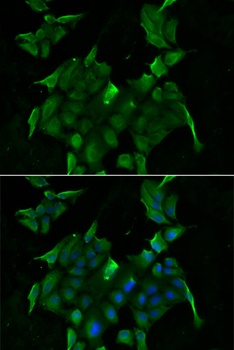 SLC34A1 Antibody