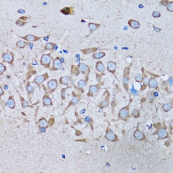 IRAK4 Antibody