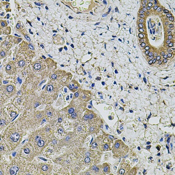 KCNK9 Antibody