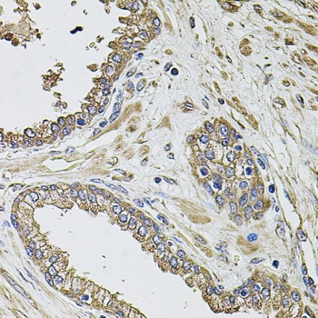KCNK9 Antibody
