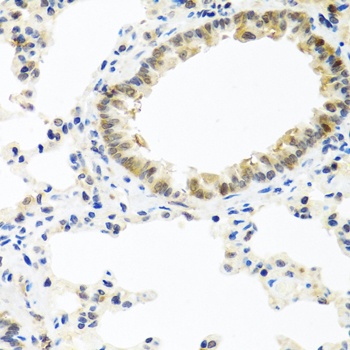 BMP5 Antibody