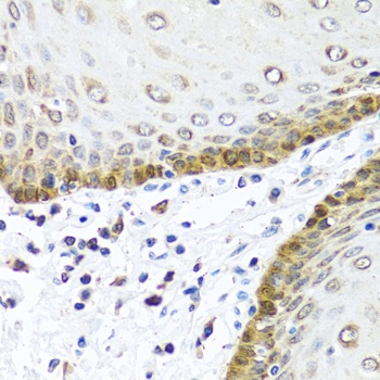 BMP5 Antibody