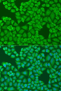 IFI44 Antibody