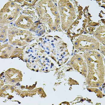 CDH6 Antibody