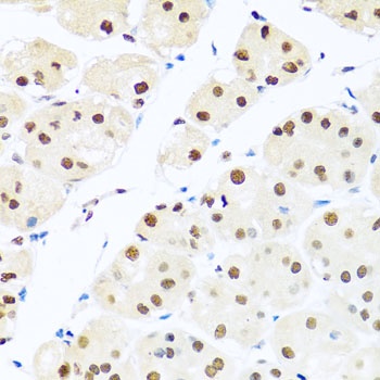 RAB3IP Antibody