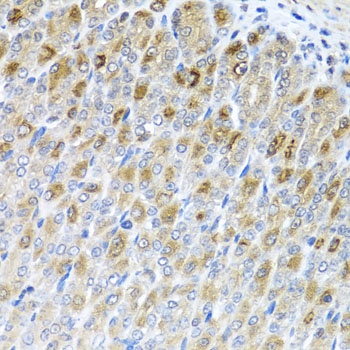MTX2 Antibody