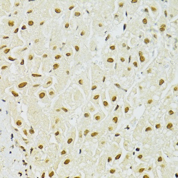 ADAR Antibody