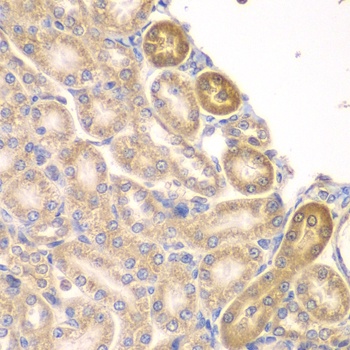 PIP4K2A Antibody