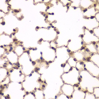PIP4K2A Antibody