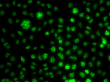 UBE2R2 Antibody