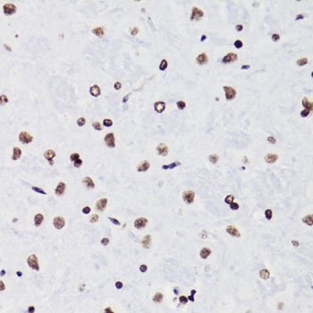 H3K18ac Antibody