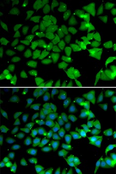 NAA10 Antibody