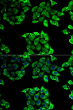 PPID Antibody