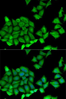 RPS7 Antibody