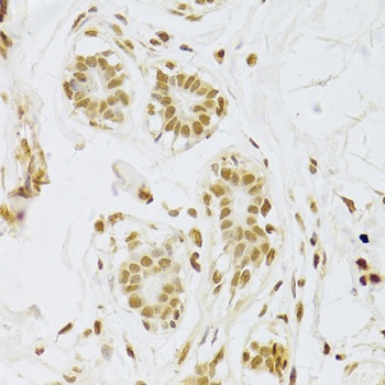 SNRPA Antibody