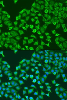 PUM1 Antibody