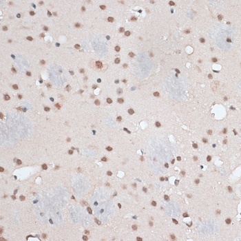 RBM3 Antibody