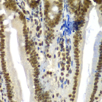 SF3B2 Antibody