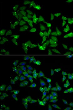 SND1 Antibody