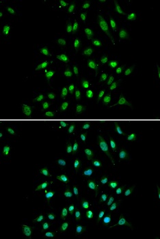 CXXC1 Antibody