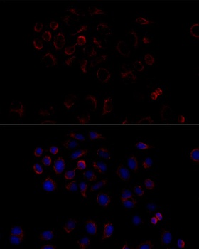 ATP5B Antibody