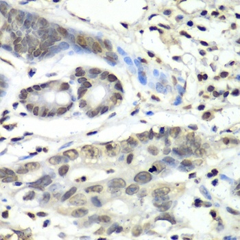 HIF1AN Antibody