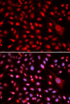 CBFB Antibody